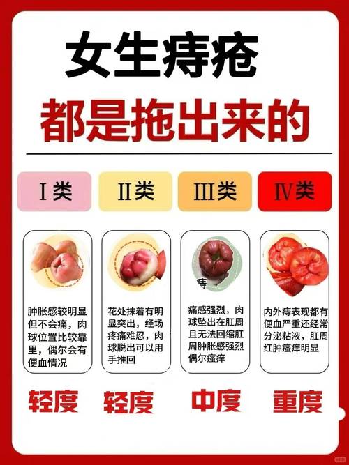 痔疮病情