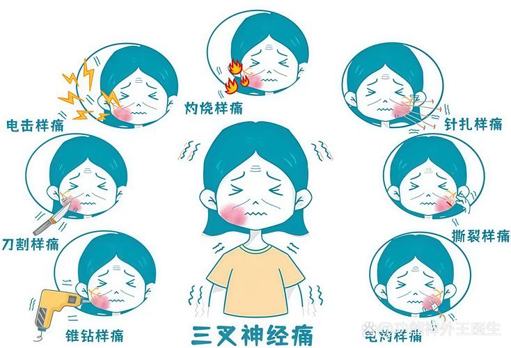 无疼痛感
