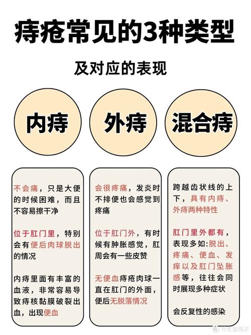 混合痔
描述: 文章详细介绍了男生痔疮的常见表现和症状，包括内痔的便血、脱出，外痔的疼痛、肿胀、瘙痒，混合痔兼具两者症状。还结合统计数据与图解分析，提醒男生重视，早发现早治疗。