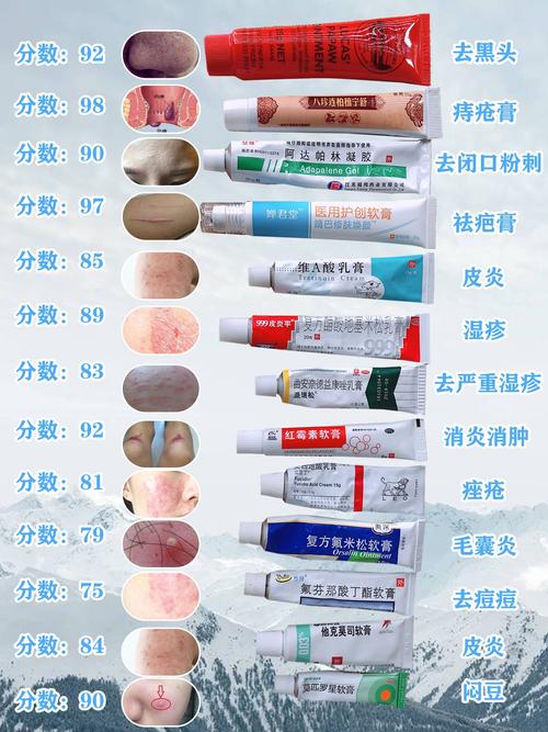 治疗痔疮乳霜