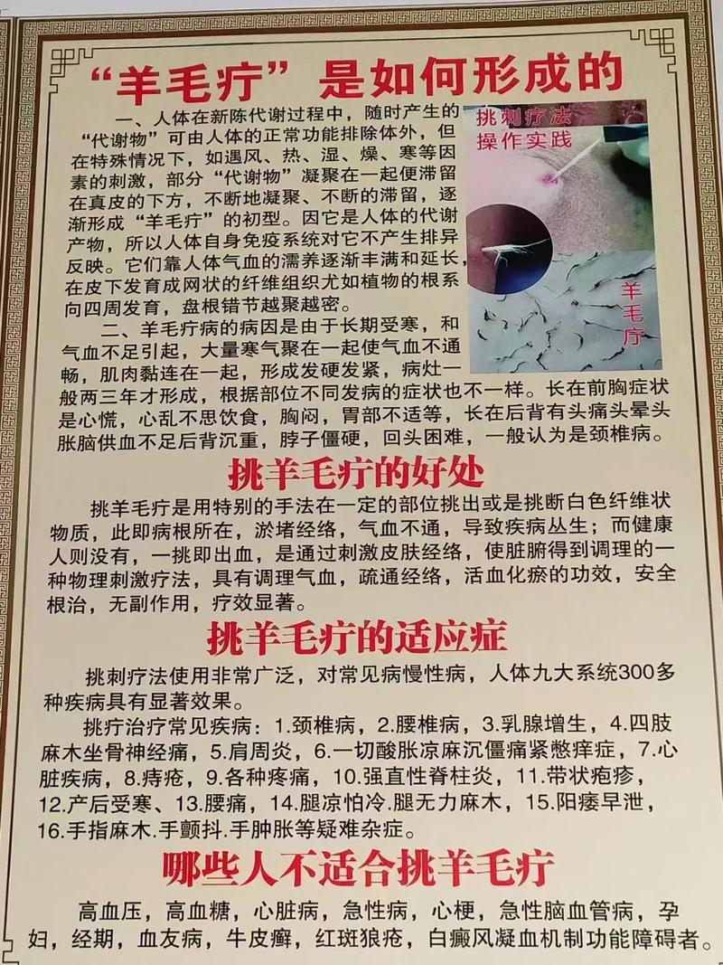 羊毛疗法