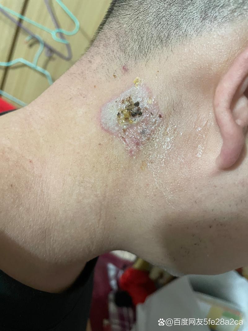白降丹