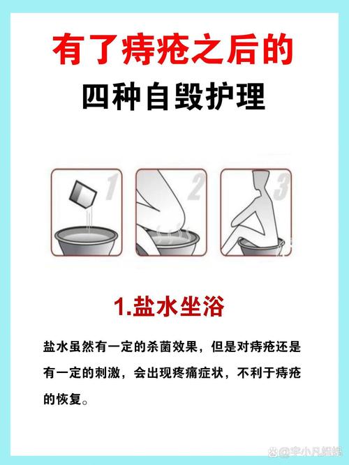食醋治疗痔疮