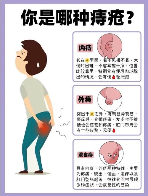 痔疮大师