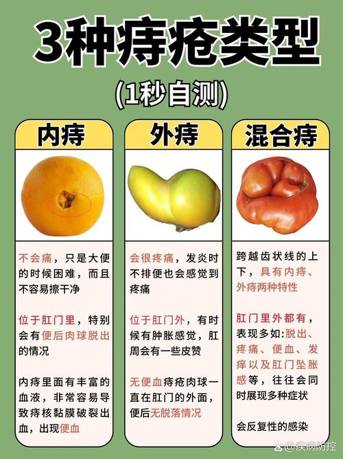 治疗
描述: 文章详细阐述了痔疮病变的定义，介绍了炎性、出血性等常见病变类型，从身体、生活、心理方面分析其影响，并给出应对办法，助读者全面认识痔疮病变，重视自身健康。