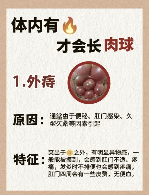 肉球痔疮