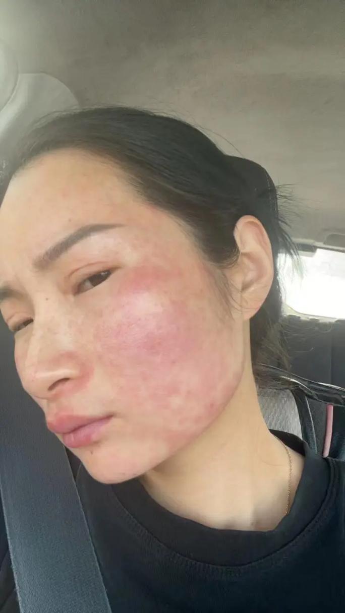 严重症状