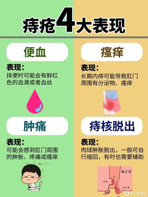 自我护理
描述: 本文详细介绍了外痔疮的成因、治疗方法，包括保守治疗和手术治疗。同时提供了全面的自我护理指南，涵盖饮食、排便习惯、运动和清洁等方面，助力读者应对外痔疮，恢复健康。