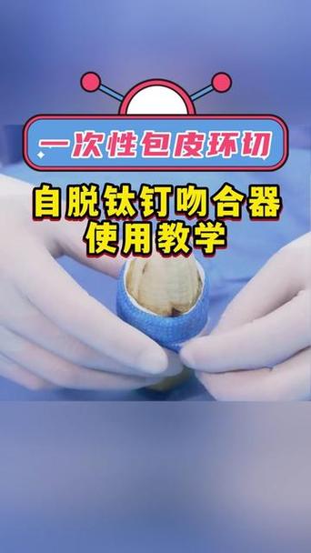 一次性切除法